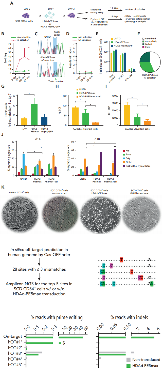 用感染 HDAd-PE5max 的 SCD 患者 CD34+ 细胞进行体外研究