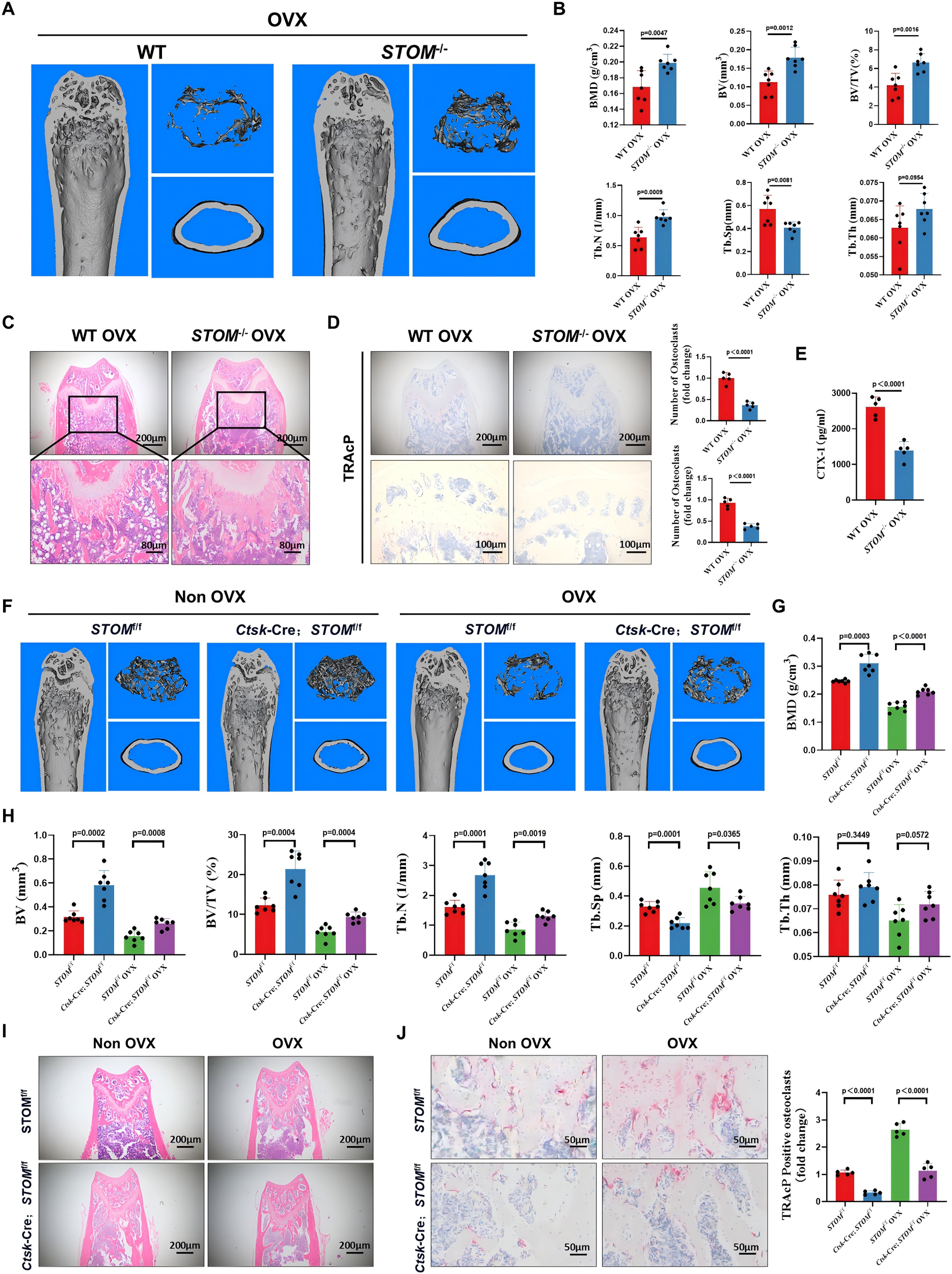 STOM 的全身性和破骨细胞特异性敲除结果