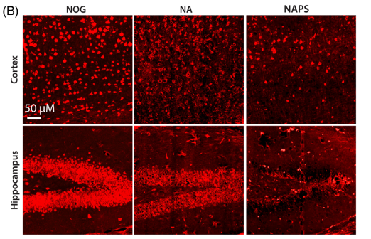 神经元丢失与脑萎缩:NeuN/MAP2染色:显示NA和NAPS小鼠皮质及海马神经元显著丢失