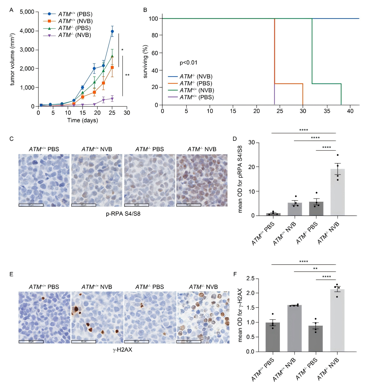 POLθ抑制在体内MCL模型中的抗肿瘤作用